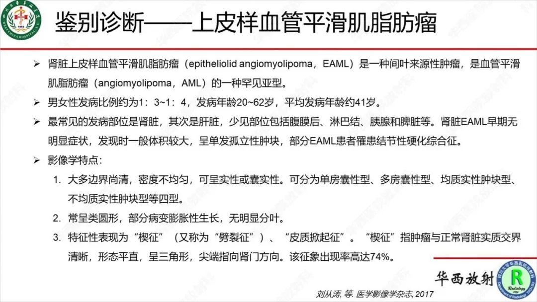 影像PPT - 【病例】肾脏滑膜肉瘤1例MR影像-29