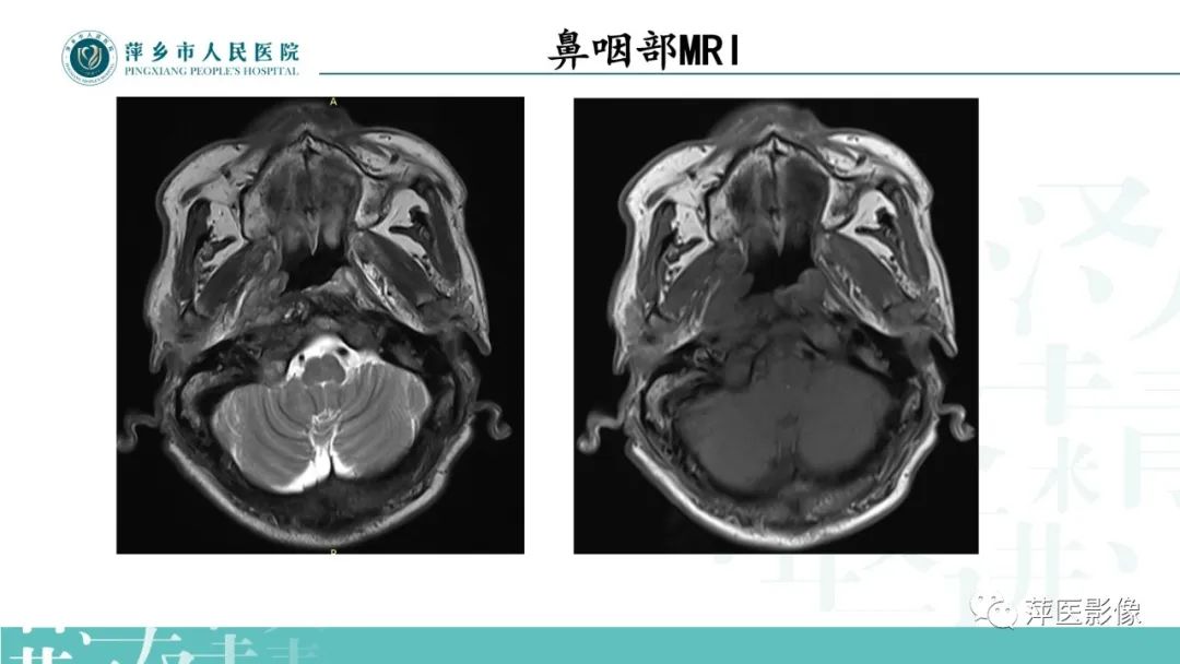 影像PPT - 【PPT】寻根问底—肝转移瘤-3