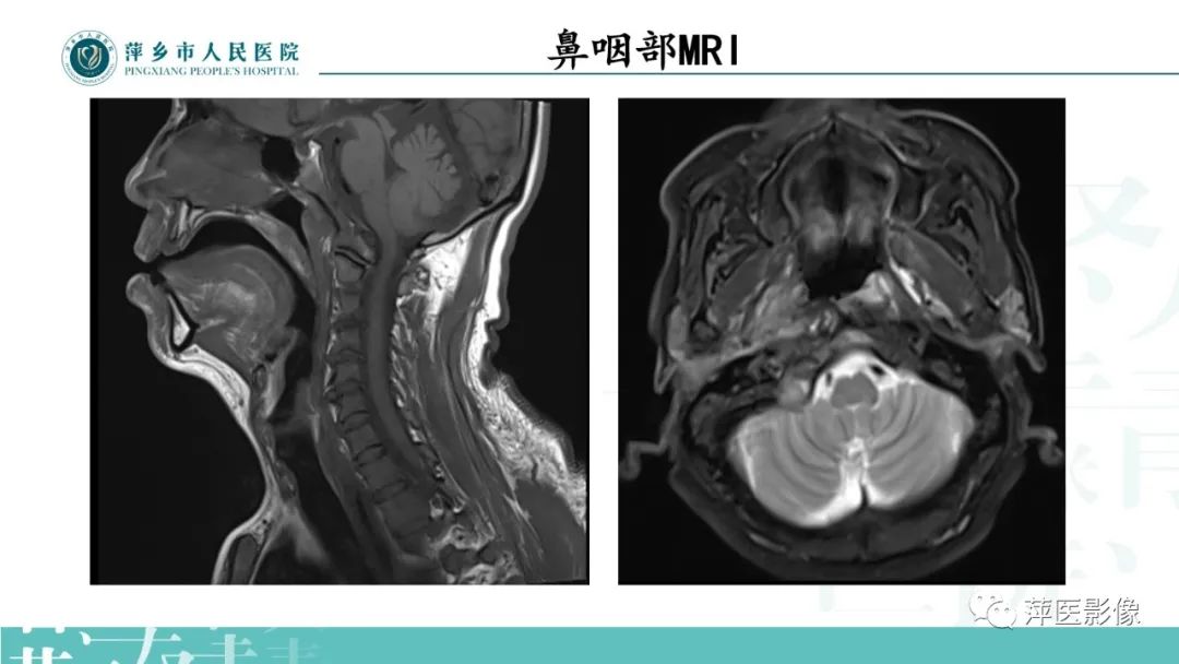 影像PPT - 【PPT】寻根问底—肝转移瘤-4