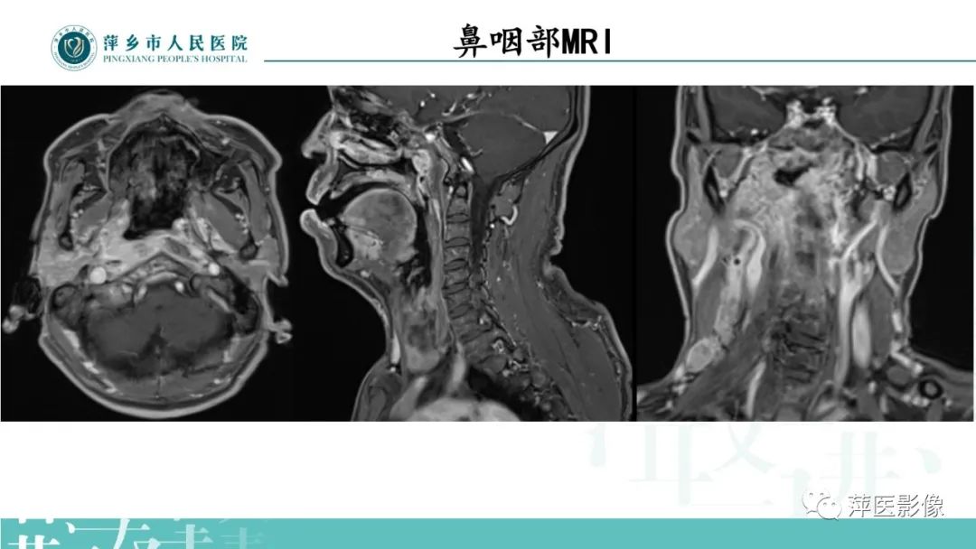 影像PPT - 【PPT】寻根问底—肝转移瘤-5