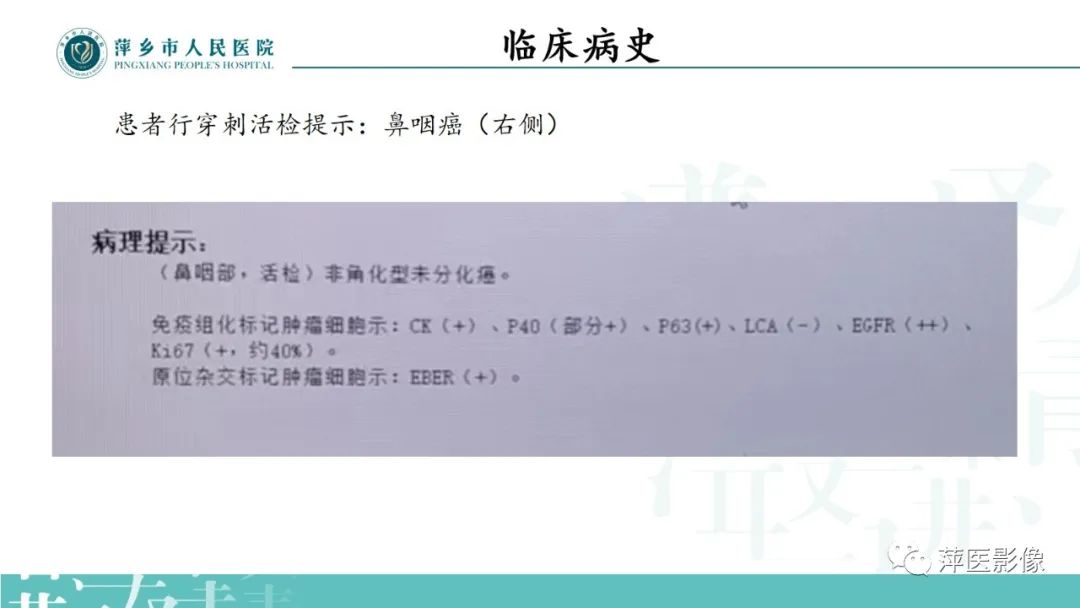 影像PPT - 【PPT】寻根问底—肝转移瘤-6