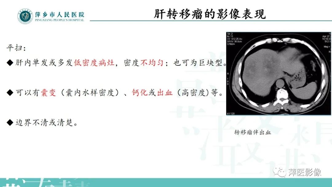 影像PPT - 【PPT】寻根问底—肝转移瘤-18