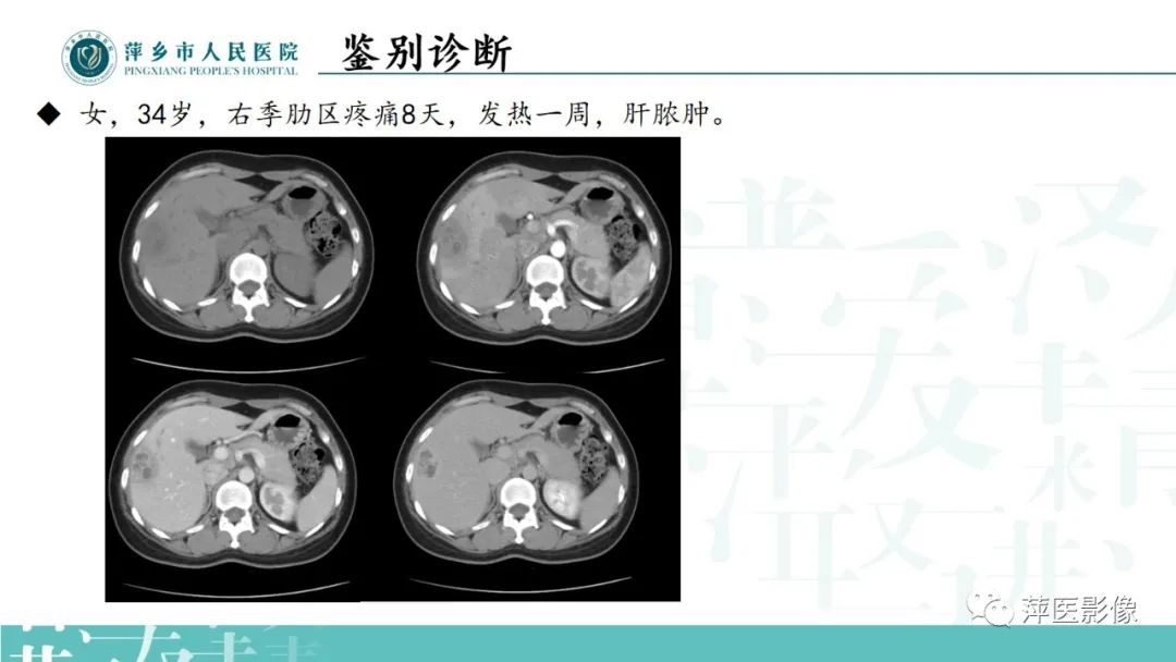 影像PPT - 【PPT】寻根问底—肝转移瘤-32