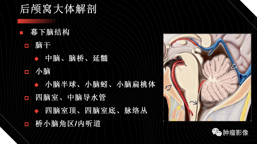 影像PPT - 【PPT】儿童后颅窝肿瘤影像诊断-4