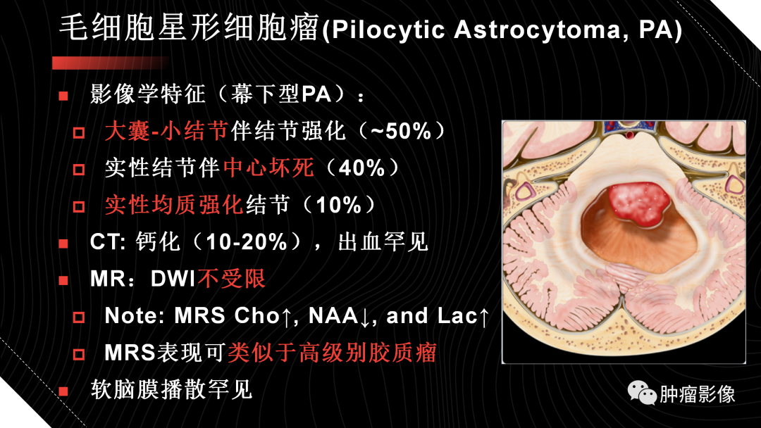 影像PPT - 【PPT】儿童后颅窝肿瘤影像诊断-10