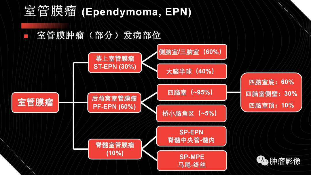 影像PPT - 【PPT】儿童后颅窝肿瘤影像诊断-36