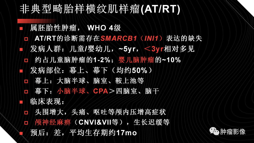 影像PPT - 【PPT】儿童后颅窝肿瘤影像诊断-51