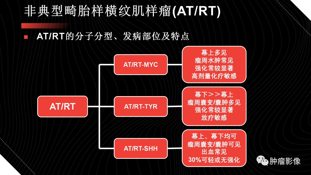影像PPT - 【PPT】儿童后颅窝肿瘤影像诊断-52