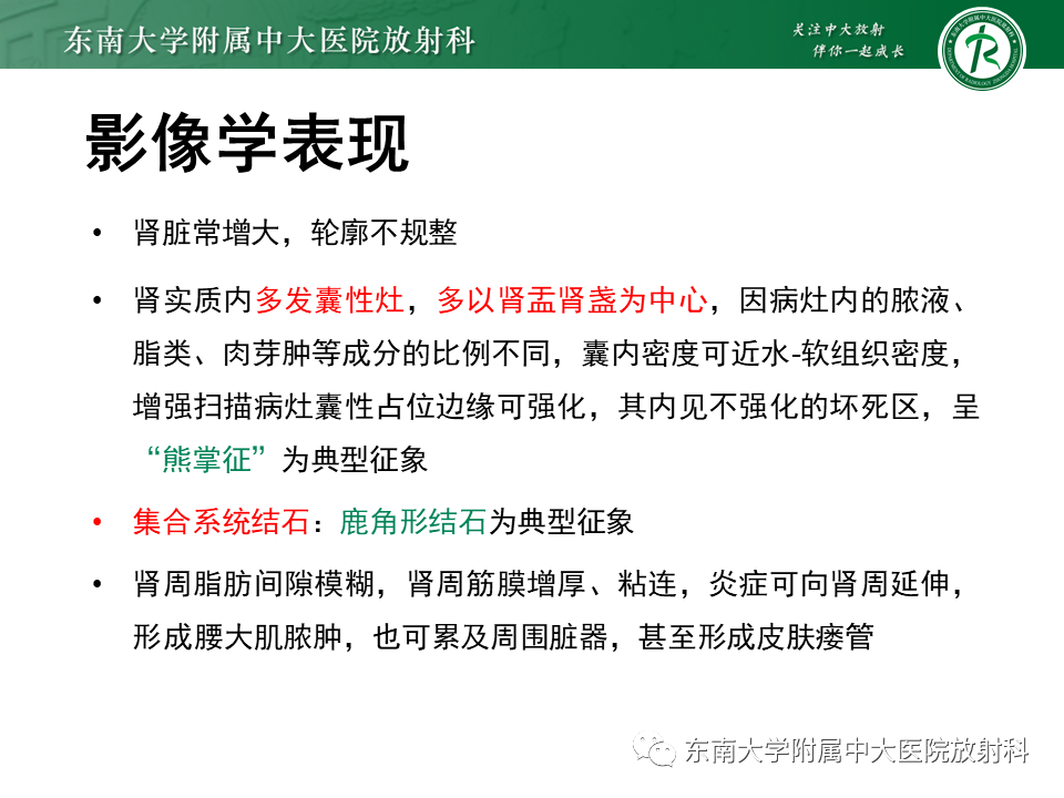 影像PPT - “条纹肾”的影像诊断意义-15 影像PPT - “条纹肾”的影像诊断意义-15