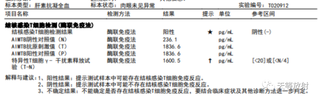影像PPT - 环礁岛征/反晕征-6 影像PPT - 环礁岛征/反晕征-6