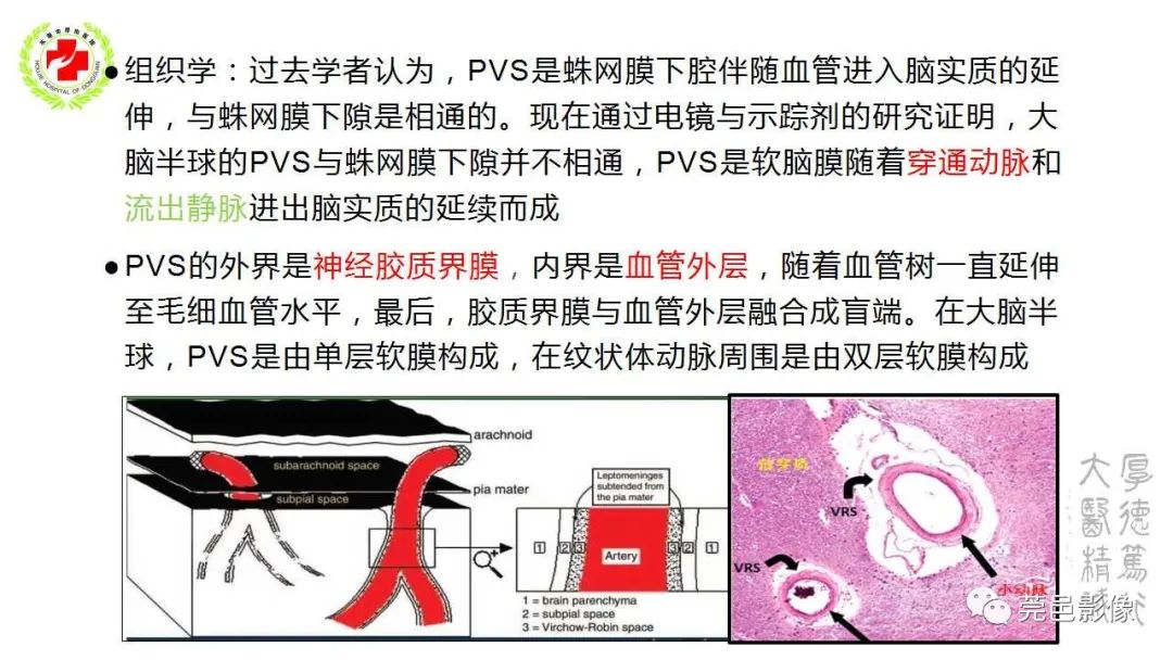 影像PPT - 【PPT】血管周围间隙及相关疾病-4