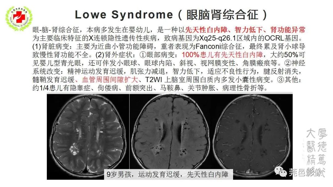 影像PPT - 【PPT】血管周围间隙及相关疾病-31