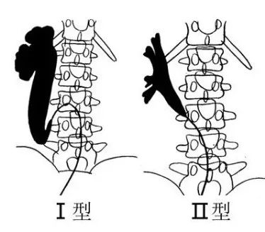 影像PPT - 【病例】环绕腔静脉输尿管/腔静脉后输尿管-9 影像PPT - 【病例】环绕腔静脉输尿管/腔静脉后输尿管-9