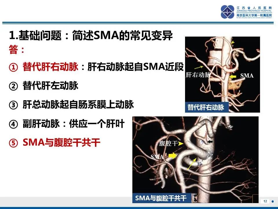 影像PPT - 【PPT】自发性孤立性肠系膜上动脉夹层-13
