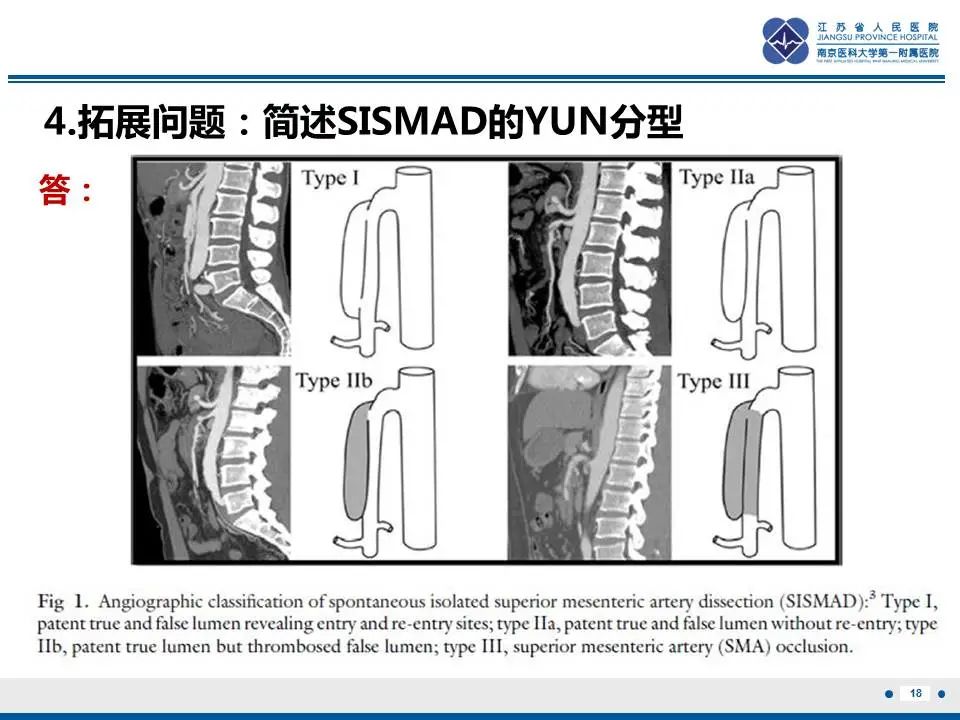 影像PPT - 【PPT】自发性孤立性肠系膜上动脉夹层-19