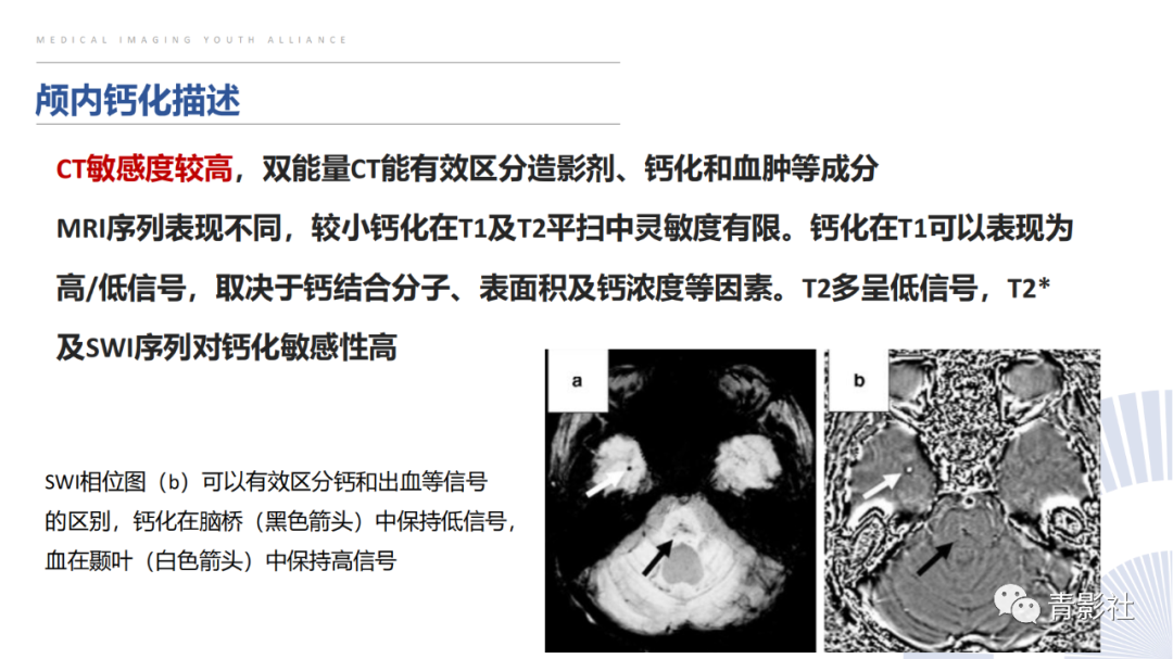 影像PPT - 【PPT】颅内钙化病变的影像诊断思路-5