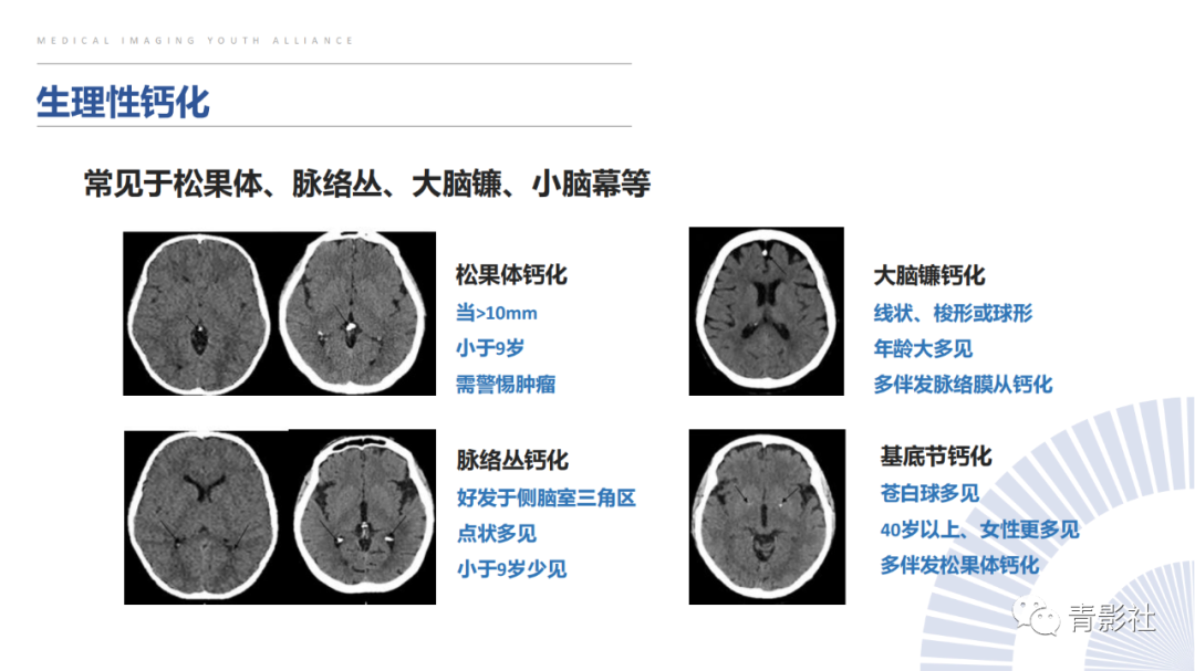 影像PPT - 【PPT】颅内钙化病变的影像诊断思路-8