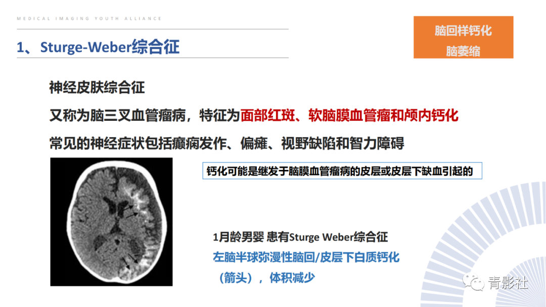 影像PPT - 【PPT】颅内钙化病变的影像诊断思路-10