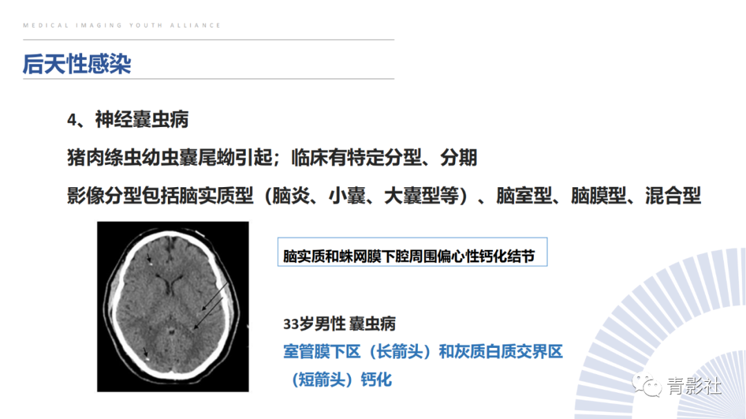 影像PPT - 【PPT】颅内钙化病变的影像诊断思路-21