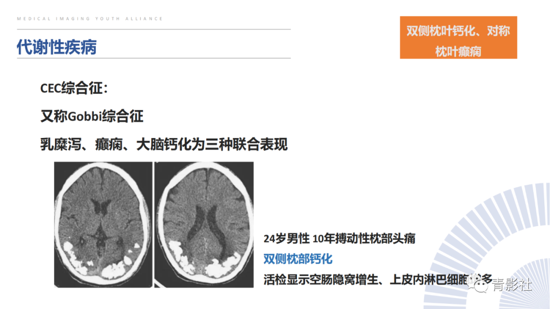 影像PPT - 【PPT】颅内钙化病变的影像诊断思路-36