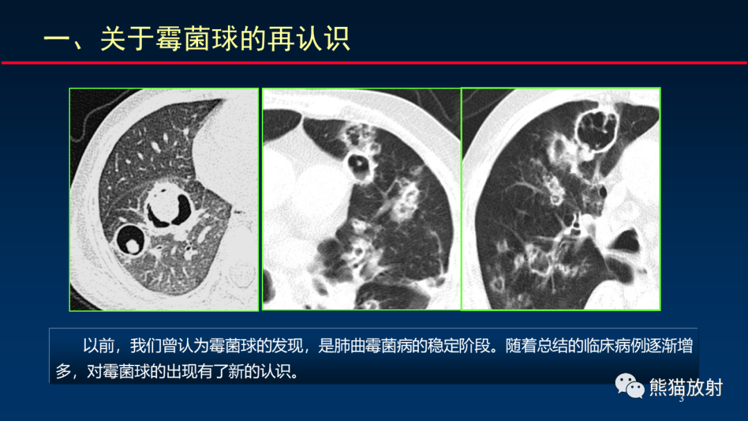 影像PPT - 【PPT】肺真菌感染的CT征象再分析-3