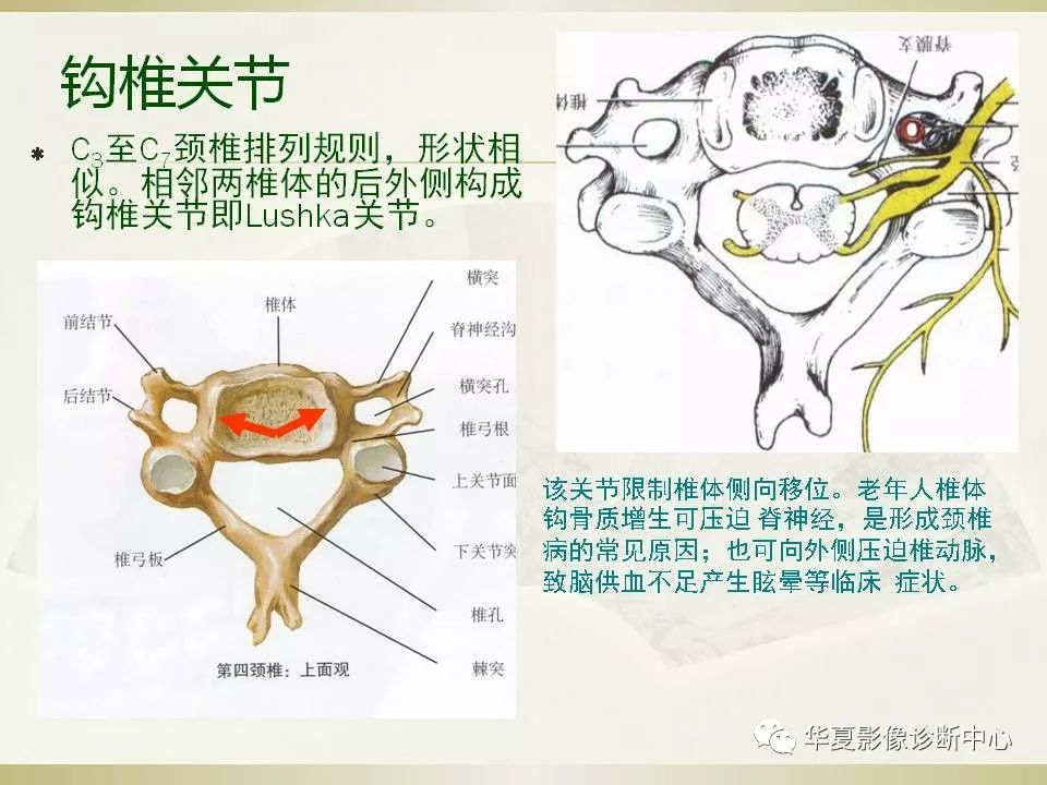 影像PPT - 【PPT】颈椎病影像诊断及临床分型-3