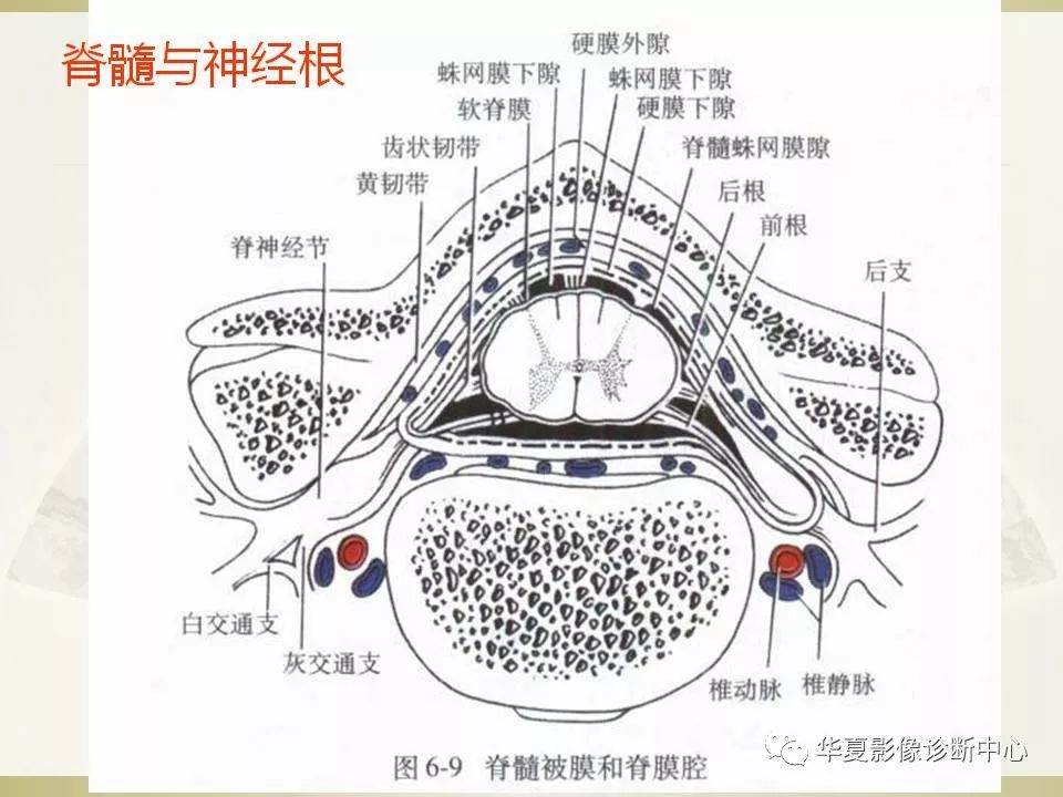 影像PPT - 【PPT】颈椎病影像诊断及临床分型-7