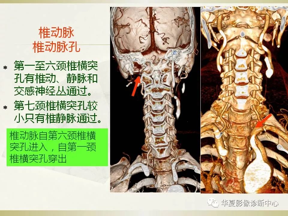 影像PPT - 【PPT】颈椎病影像诊断及临床分型-8