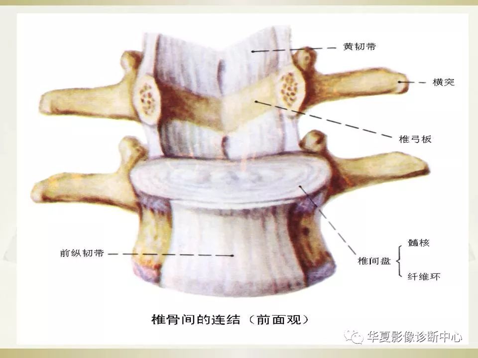 影像PPT - 【PPT】颈椎病影像诊断及临床分型-11