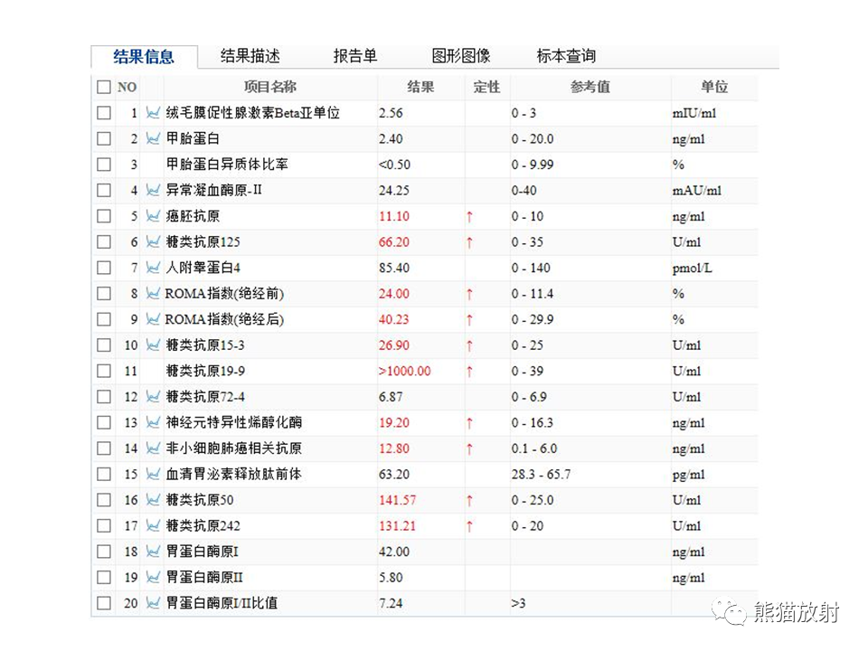 影像PPT - 【病例】肝内胆管细胞癌2例MR影像-4