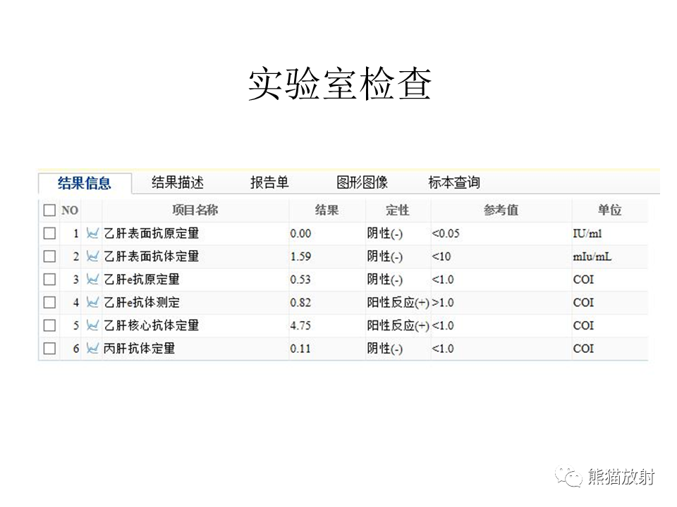 影像PPT - 【病例】肝内胆管细胞癌2例MR影像-3