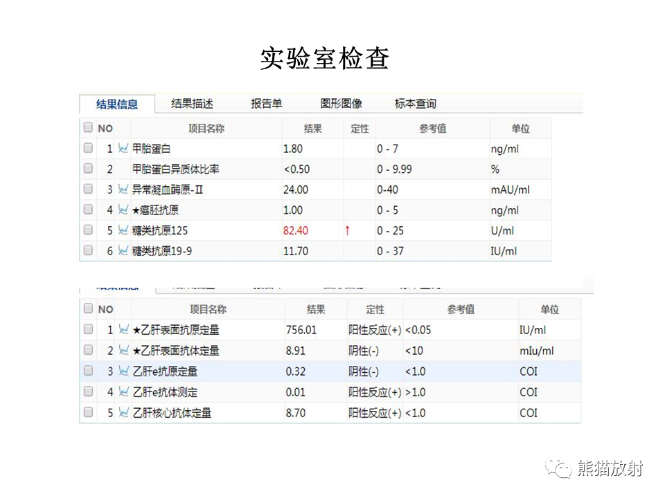 影像PPT - 【病例】肝内胆管细胞癌2例MR影像-10