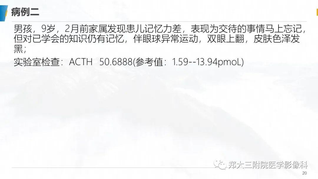 影像PPT - 【PPT】肾上腺脑白质营养不良影像诊断-20