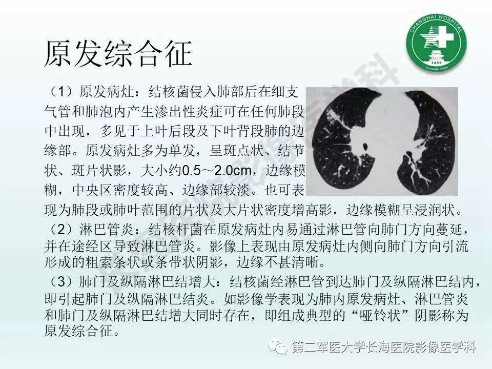 影像PPT - 【PPT】结核影像诊断-9 影像PPT - 【PPT】结核影像诊断-9