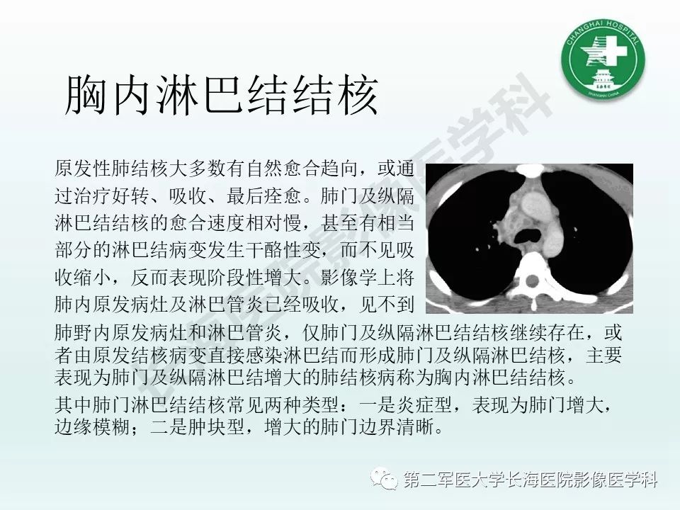 影像PPT - 【PPT】结核影像诊断-10 影像PPT - 【PPT】结核影像诊断-10