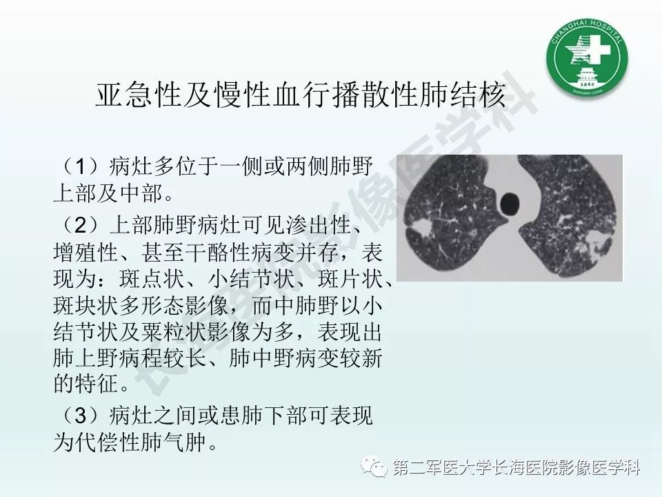 影像PPT - 【PPT】结核影像诊断-12 影像PPT - 【PPT】结核影像诊断-12