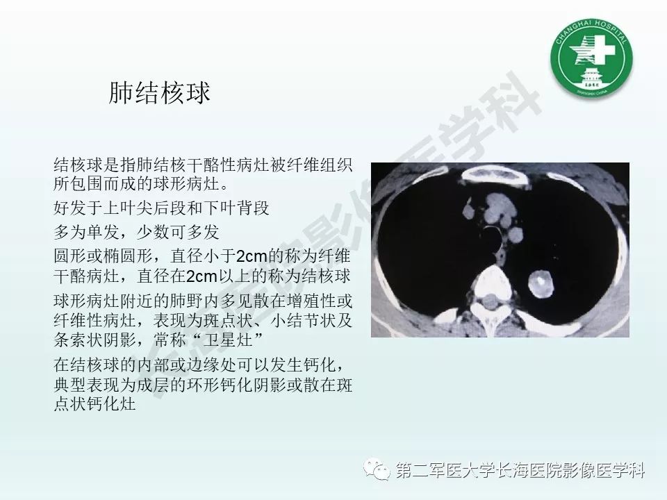 影像PPT - 【PPT】结核影像诊断-16 影像PPT - 【PPT】结核影像诊断-16