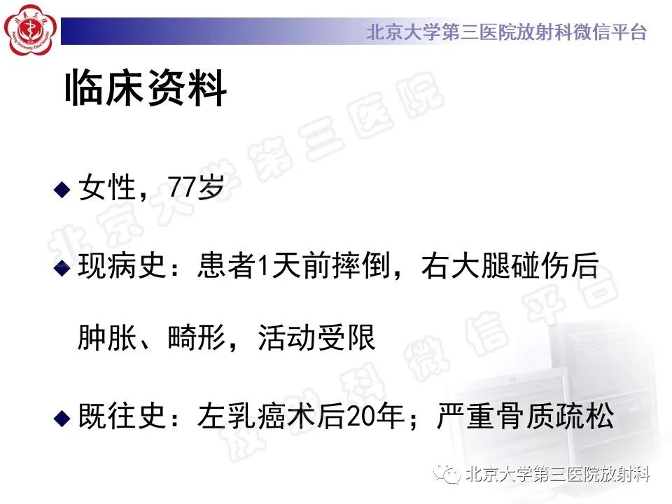 影像PPT - 【PPT】非典型股骨骨折-2