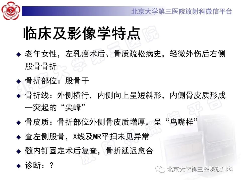 影像PPT - 【PPT】非典型股骨骨折-8