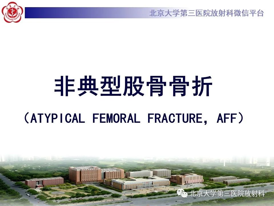 影像PPT - 【PPT】非典型股骨骨折-9