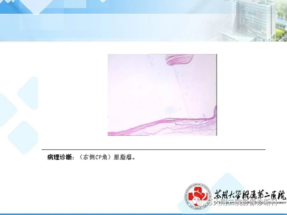 影像PPT - 【PPT】脑桥小脑角区常见占位性病变-9