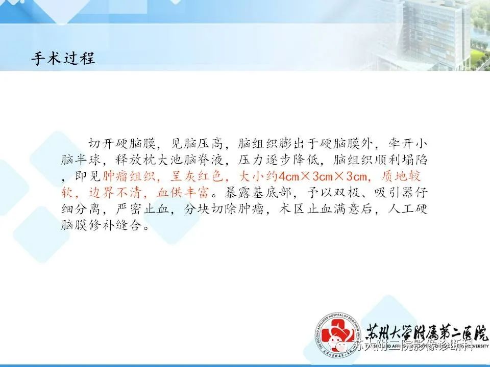 影像PPT - 【PPT】脑桥小脑角区常见占位性病变-25