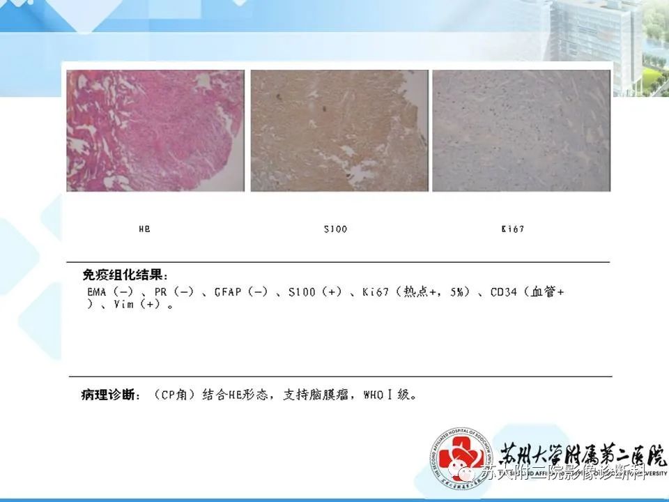 影像PPT - 【PPT】脑桥小脑角区常见占位性病变-26