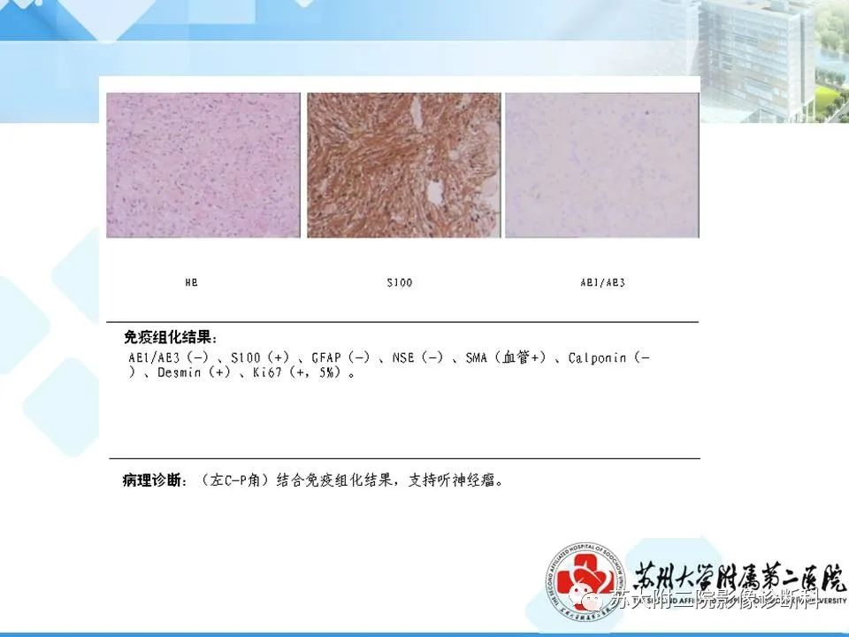 影像PPT - 【PPT】脑桥小脑角区常见占位性病变-34