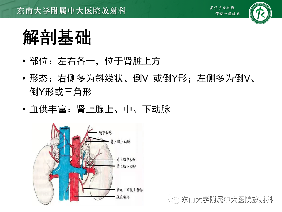 影像PPT - 【PPT】肾上腺嗜铬细胞瘤CT诊断与鉴别诊断-5 影像PPT - 【PPT】肾上腺嗜铬细胞瘤CT诊断与鉴别诊断-5