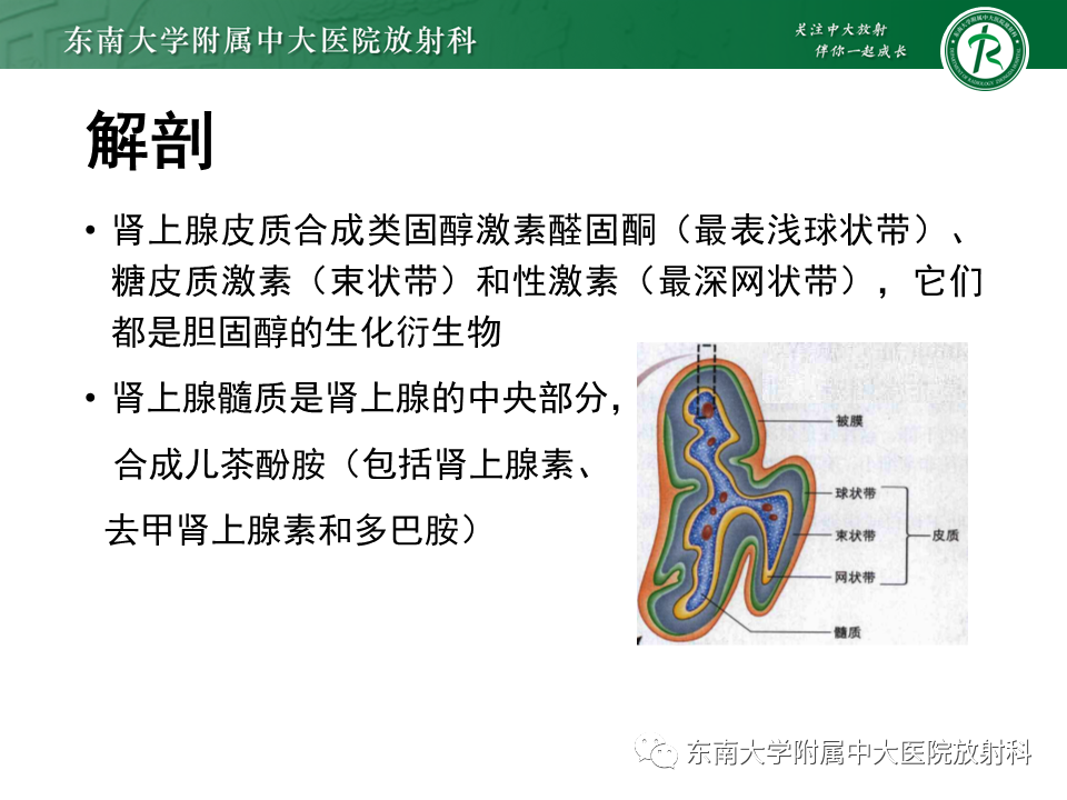 影像PPT - 【PPT】肾上腺嗜铬细胞瘤CT诊断与鉴别诊断-6 影像PPT - 【PPT】肾上腺嗜铬细胞瘤CT诊断与鉴别诊断-6