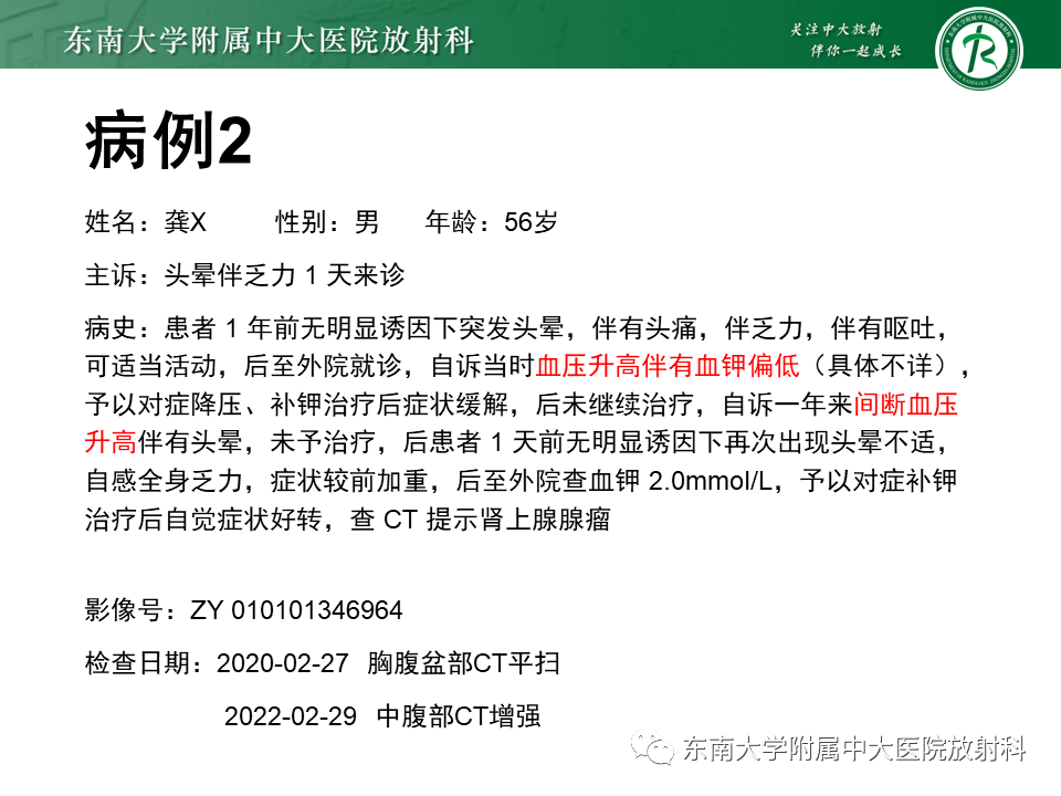 影像PPT - 【PPT】肾上腺嗜铬细胞瘤CT诊断与鉴别诊断-12 影像PPT - 【PPT】肾上腺嗜铬细胞瘤CT诊断与鉴别诊断-12