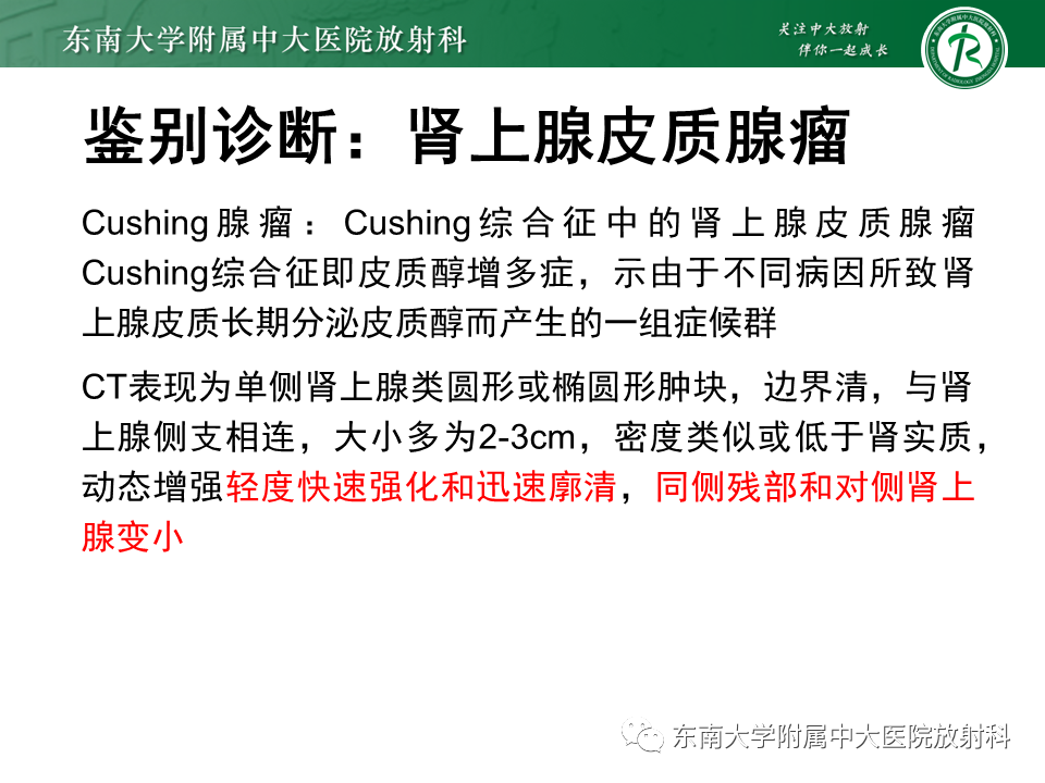 影像PPT - 【PPT】肾上腺嗜铬细胞瘤CT诊断与鉴别诊断-15 影像PPT - 【PPT】肾上腺嗜铬细胞瘤CT诊断与鉴别诊断-15