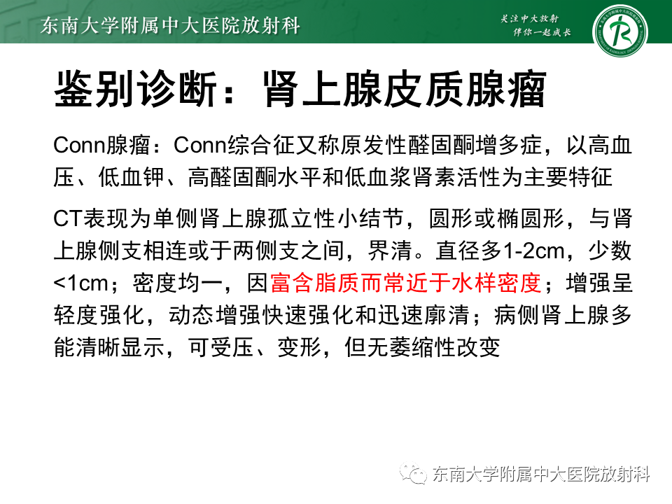 影像PPT - 【PPT】肾上腺嗜铬细胞瘤CT诊断与鉴别诊断-16 影像PPT - 【PPT】肾上腺嗜铬细胞瘤CT诊断与鉴别诊断-16