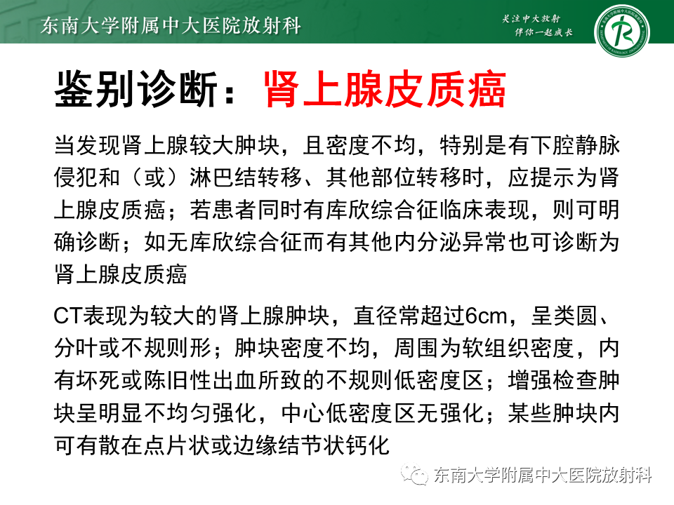 影像PPT - 【PPT】肾上腺嗜铬细胞瘤CT诊断与鉴别诊断-20 影像PPT - 【PPT】肾上腺嗜铬细胞瘤CT诊断与鉴别诊断-20